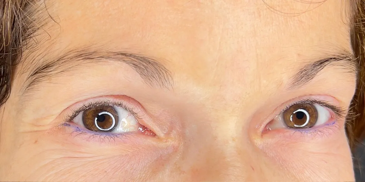 Microblading: resultado real: antes