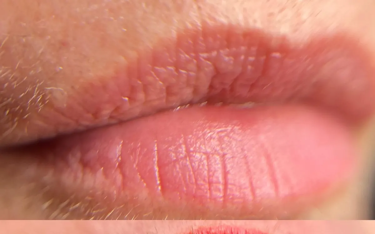 Micropigmentación de labios: resultado real: antes