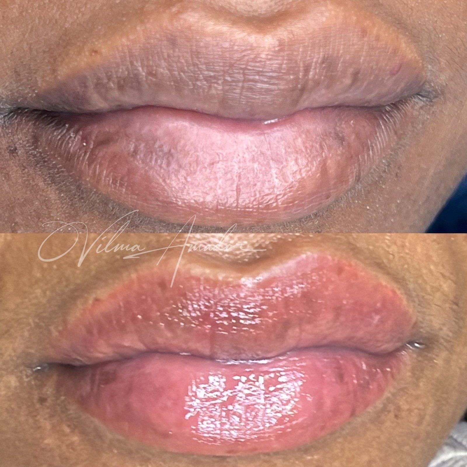 Micropigmentación de labios en Murcia, resultado de Vilma Amador
